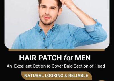 Anassheikh Parmanent hair patch Solution (2)