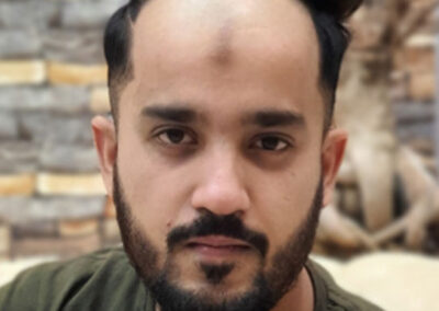 anassheikhhairpatch-4