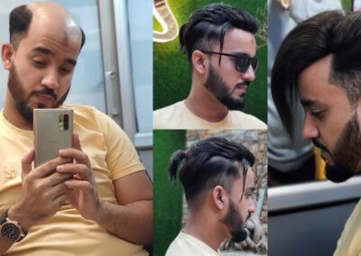 anassheikhhairpatch (8)